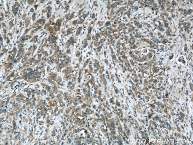 Stanniocalcin 2 Antibody in Immunohistochemistry (Paraffin) (IHC (P))