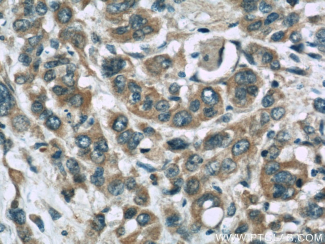 Stanniocalcin 2 Antibody in Immunohistochemistry (Paraffin) (IHC (P))