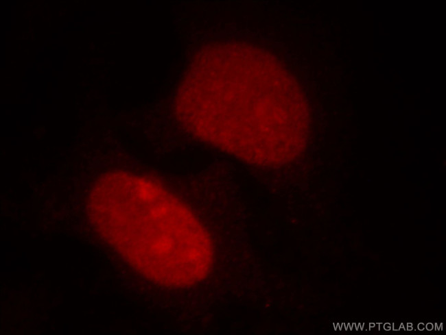 HDGF Antibody in Immunocytochemistry (ICC/IF)