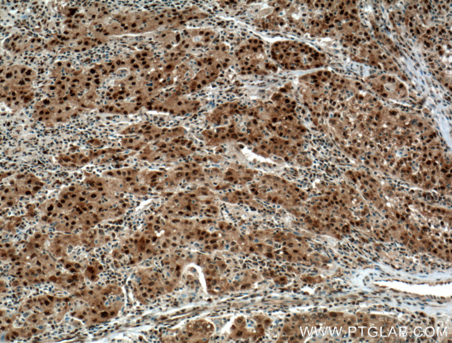 HDGF Antibody in Immunohistochemistry (Paraffin) (IHC (P))