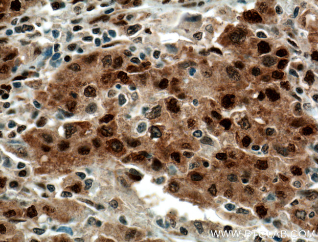 HDGF Antibody in Immunohistochemistry (Paraffin) (IHC (P))