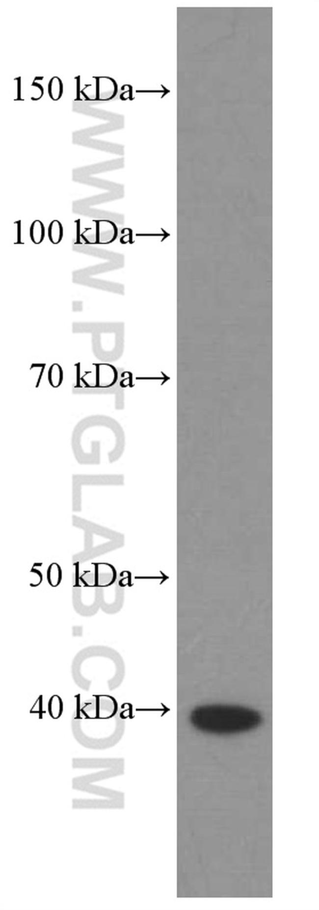 HDGF Antibody in Western Blot (WB)