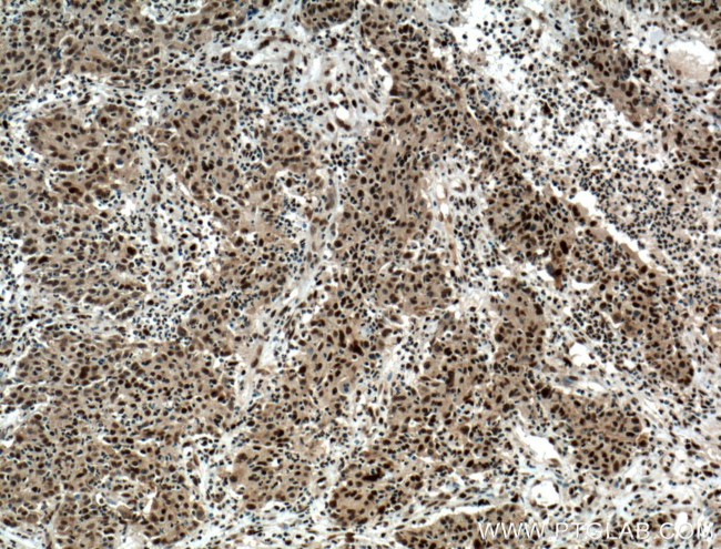 HDGF Antibody in Immunohistochemistry (Paraffin) (IHC (P))