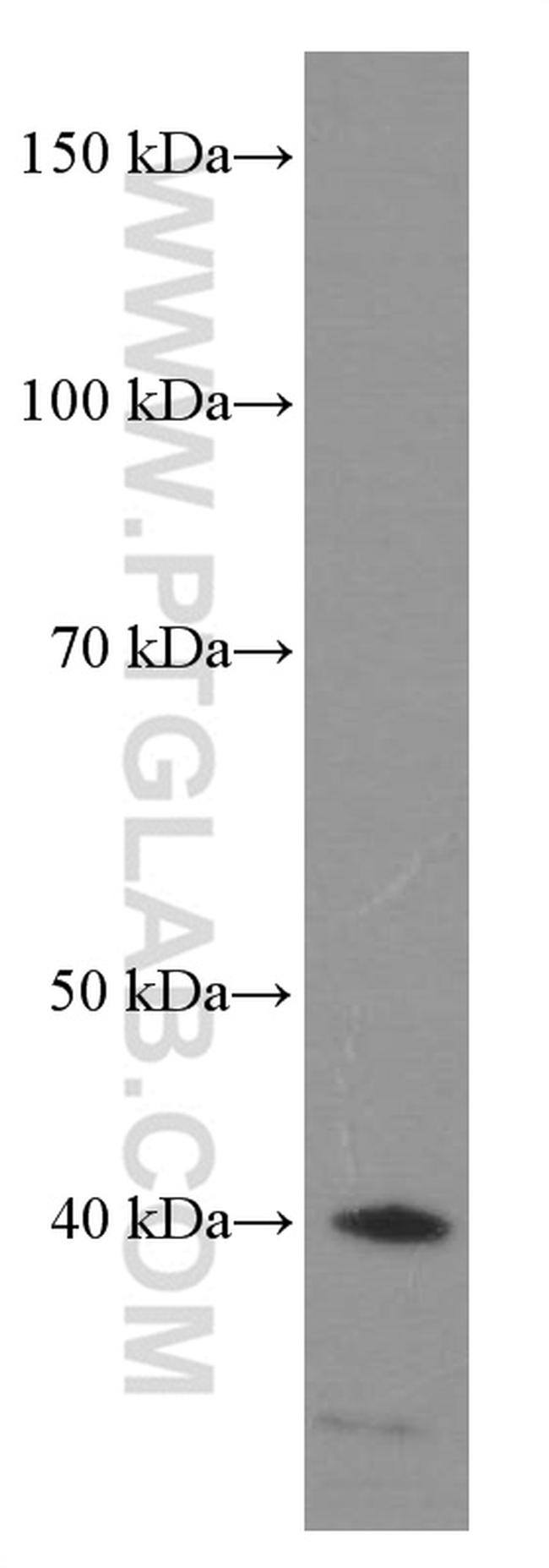 HDGF Antibody in Western Blot (WB)