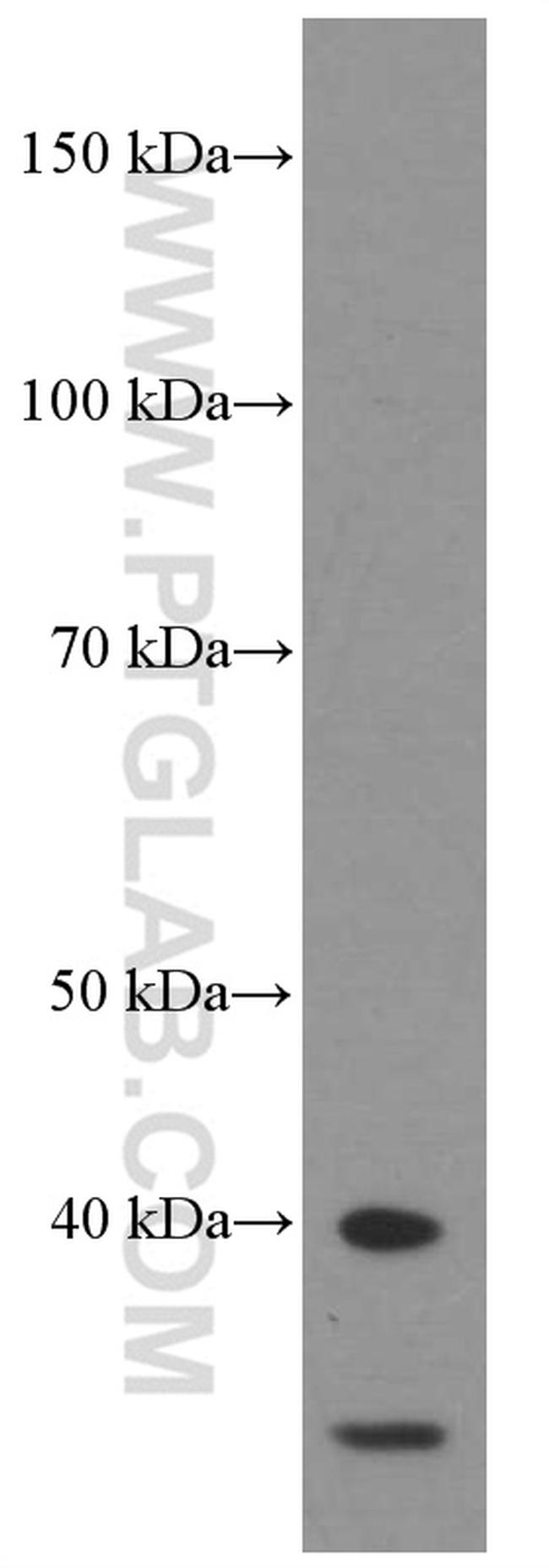 HDGF Antibody in Western Blot (WB)