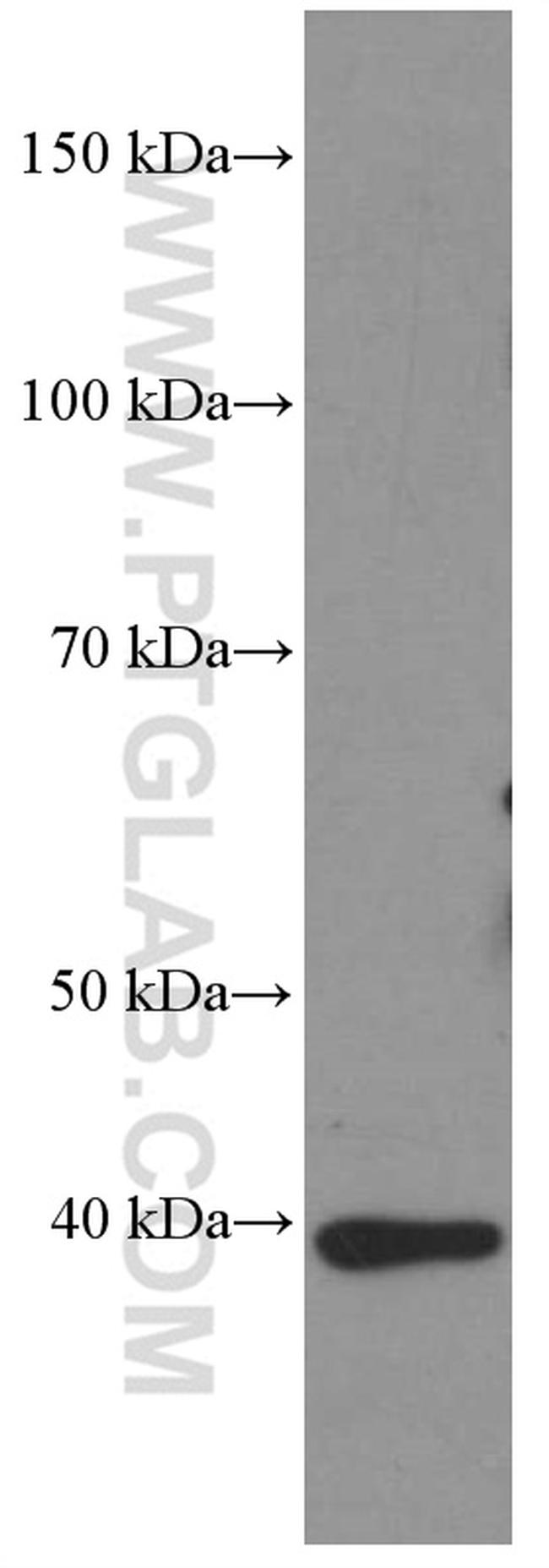 HDGF Antibody in Western Blot (WB)