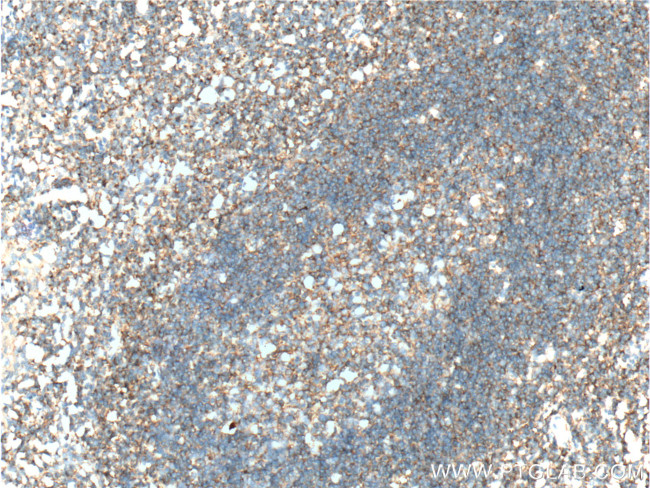 CXCR3B Antibody in Immunohistochemistry (Paraffin) (IHC (P))