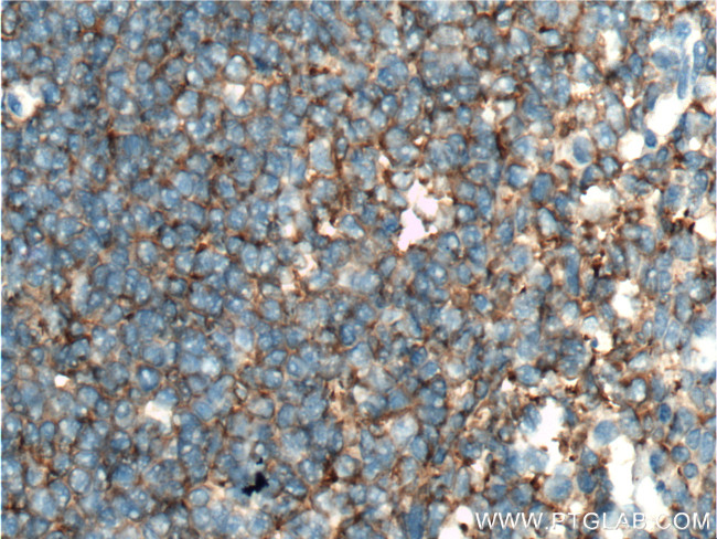 CXCR3B Antibody in Immunohistochemistry (Paraffin) (IHC (P))