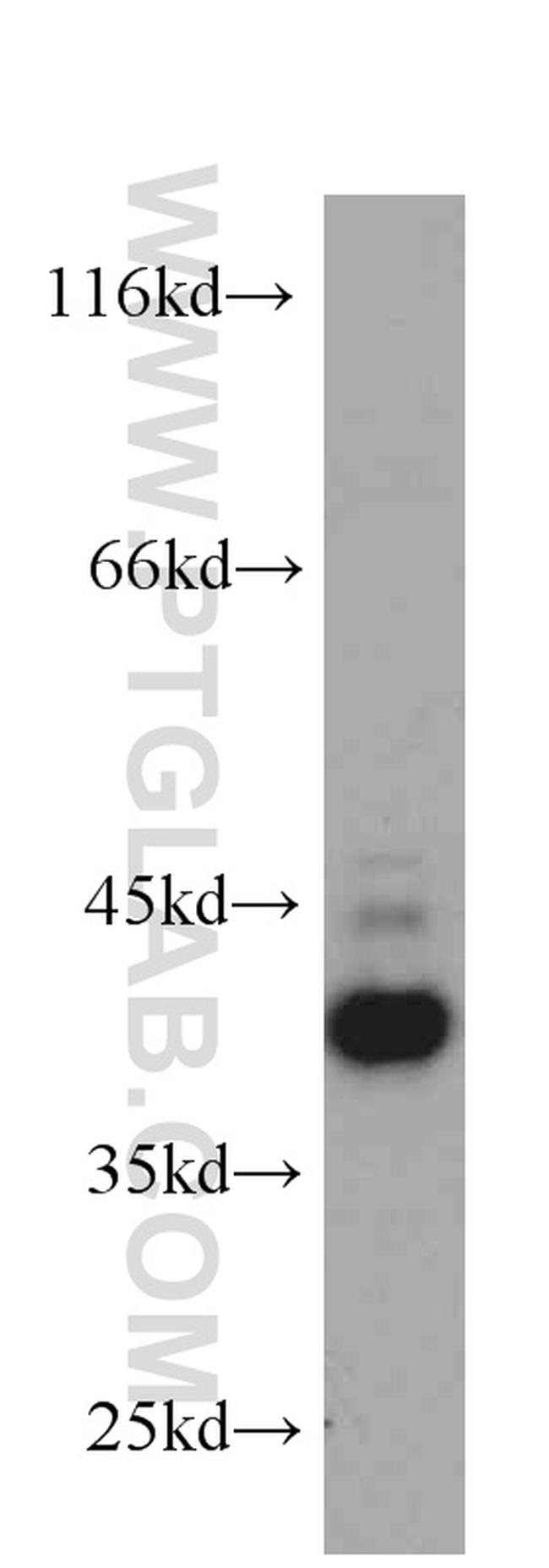 CXCR3B Antibody in Western Blot (WB)