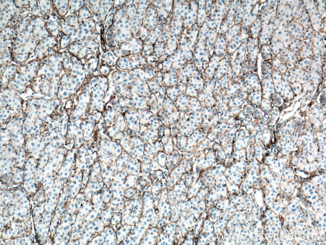 CXCR3B Antibody in Immunohistochemistry (Paraffin) (IHC (P))