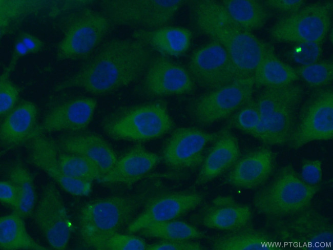 LGALS3BP Antibody in Immunocytochemistry (ICC/IF)