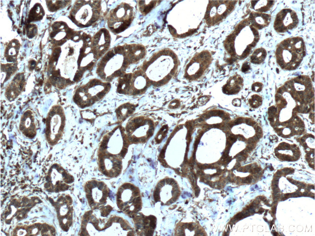 LGALS3BP Antibody in Immunohistochemistry (Paraffin) (IHC (P))