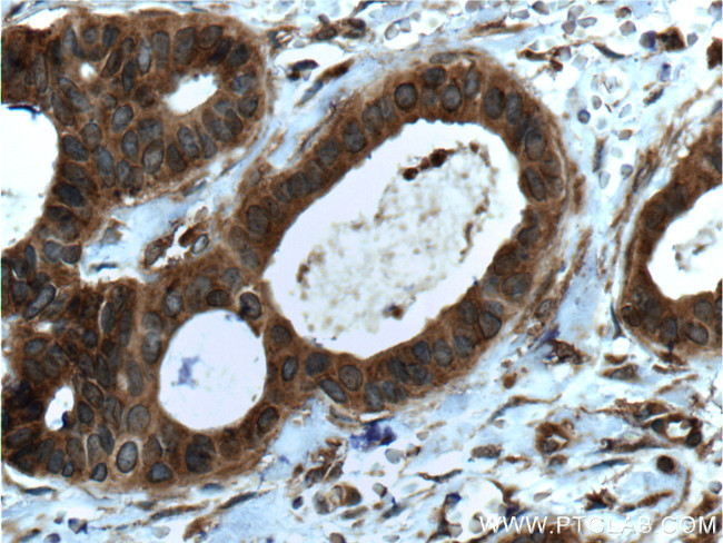 LGALS3BP Antibody in Immunohistochemistry (Paraffin) (IHC (P))