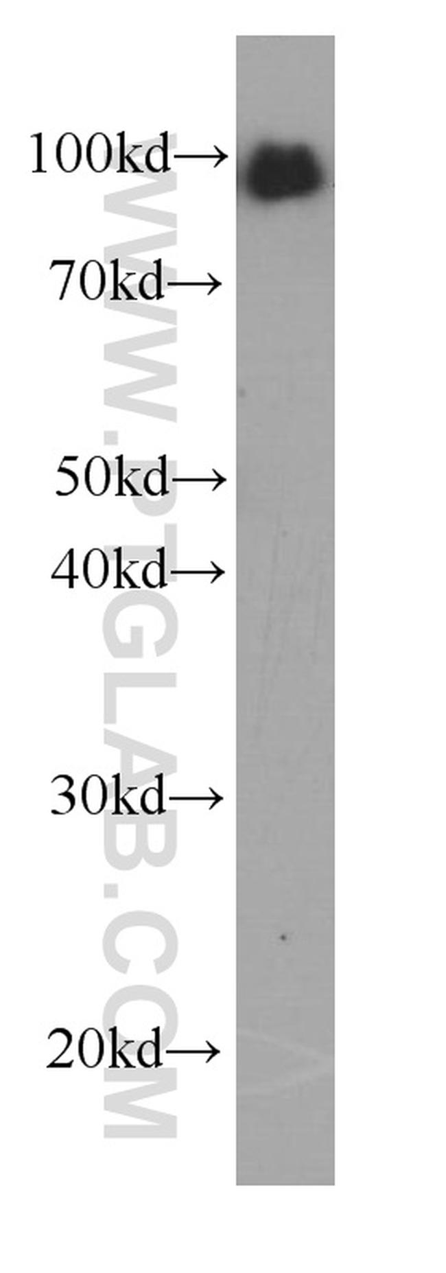 LGALS3BP Antibody in Western Blot (WB)