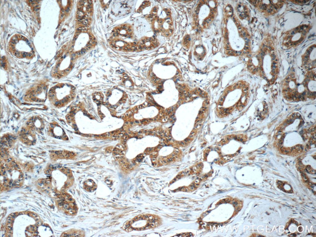 LGALS3BP Antibody in Immunohistochemistry (Paraffin) (IHC (P))