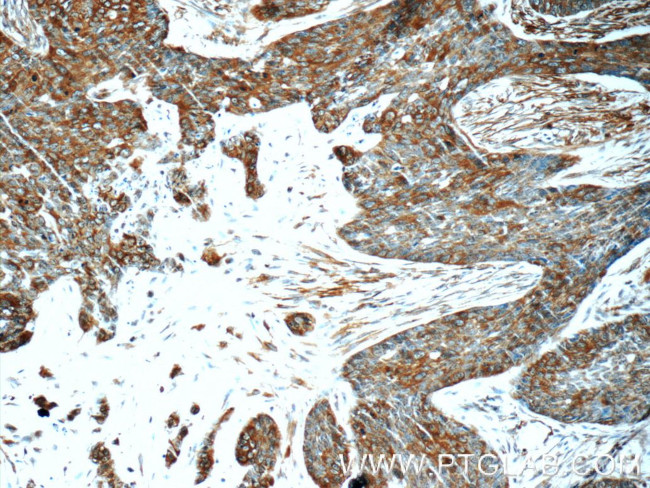 LGALS3BP Antibody in Immunohistochemistry (Paraffin) (IHC (P))