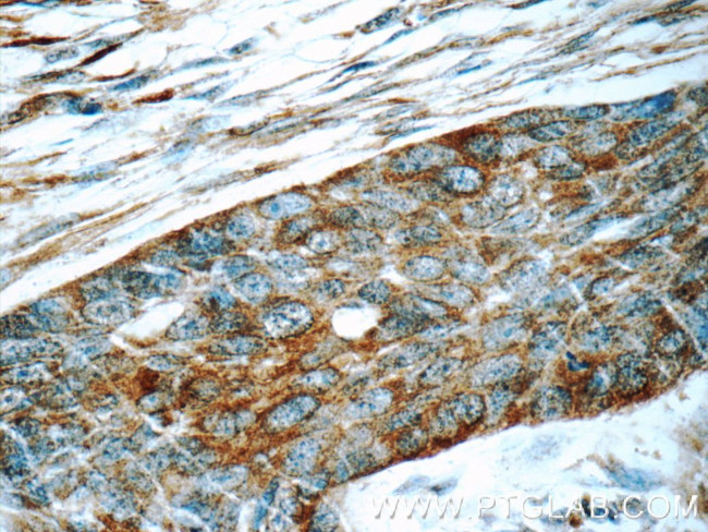 LGALS3BP Antibody in Immunohistochemistry (Paraffin) (IHC (P))