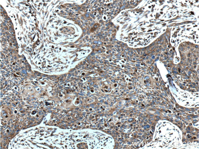 LGALS3BP Antibody in Immunohistochemistry (Paraffin) (IHC (P))