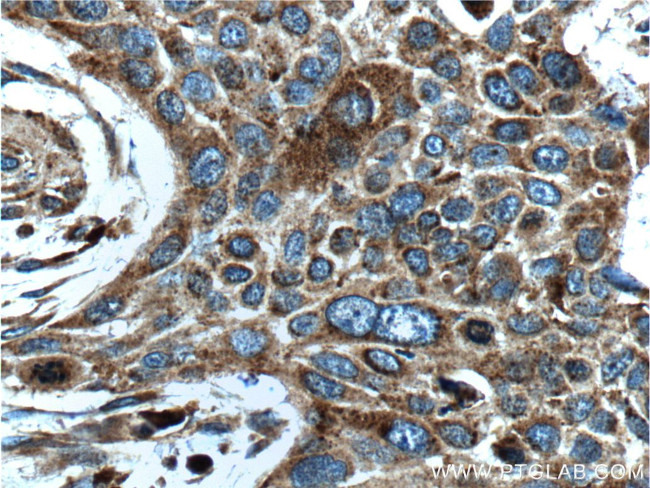 LGALS3BP Antibody in Immunohistochemistry (Paraffin) (IHC (P))