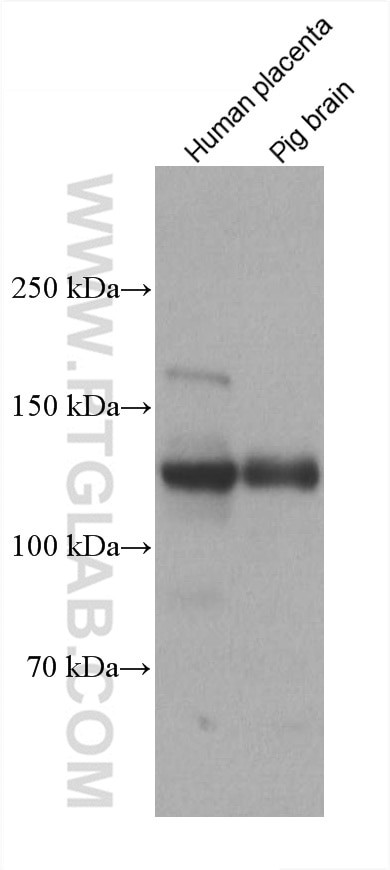 Neuropilin 1 Antibody in Western Blot (WB)