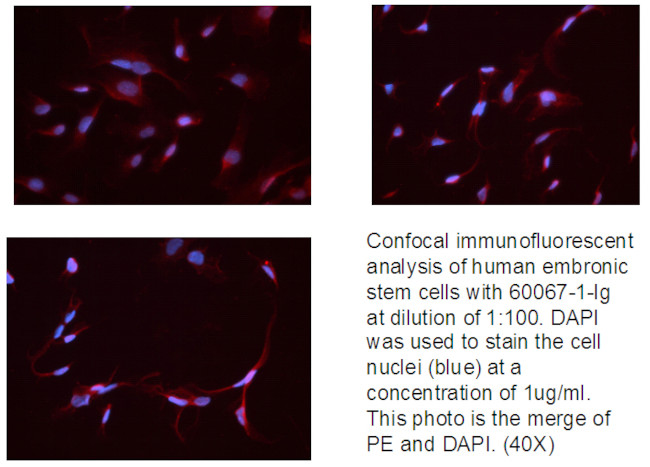 Neuropilin 1 Antibody in Immunocytochemistry (ICC/IF)