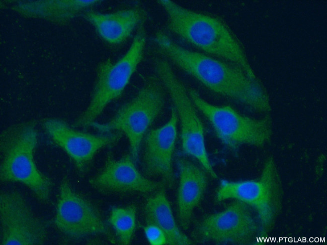 Neuropilin 1 Antibody in Immunocytochemistry (ICC/IF)