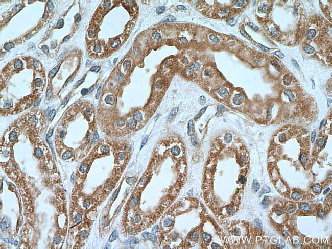 Neuropilin 1 Antibody in Immunohistochemistry (Paraffin) (IHC (P))