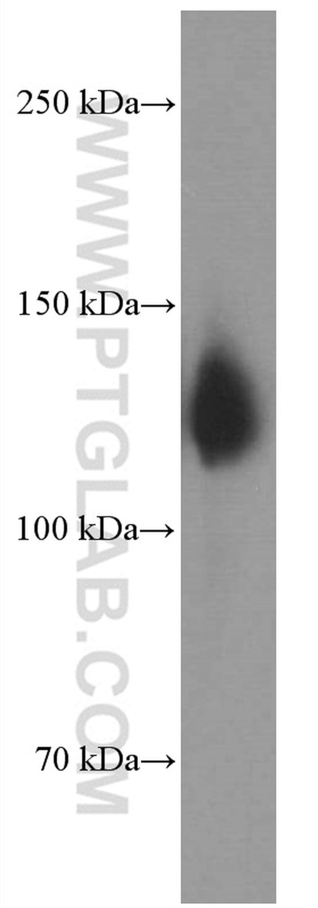 Neuropilin 1 Antibody in Western Blot (WB)