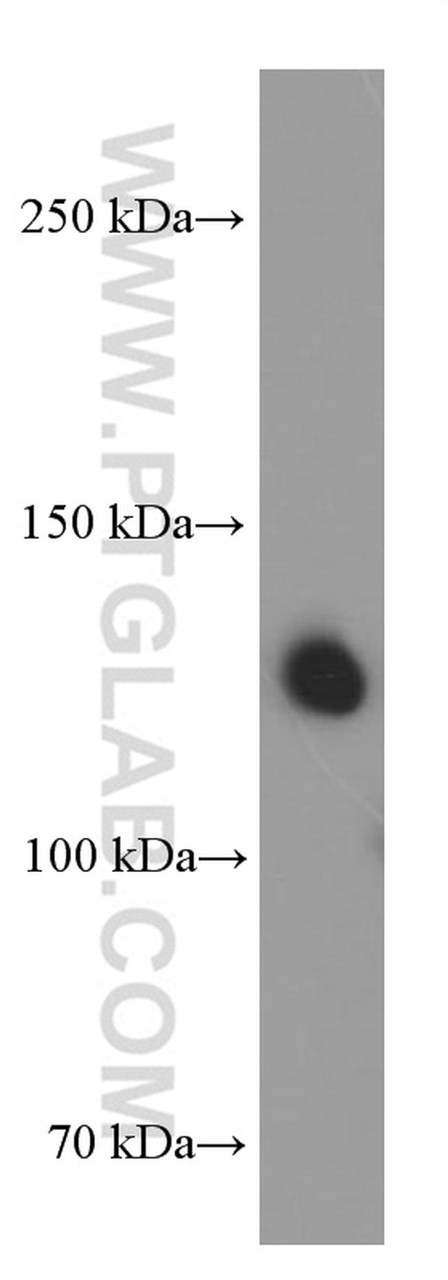 Neuropilin 1 Antibody in Western Blot (WB)