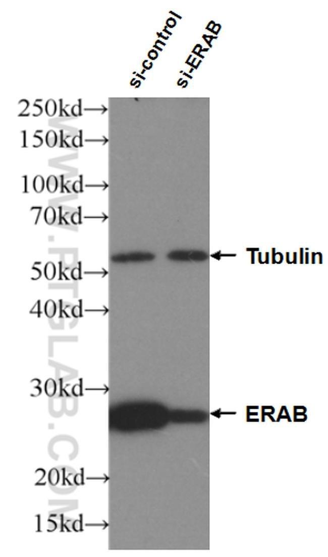 ERAB Antibody in Western Blot (WB)