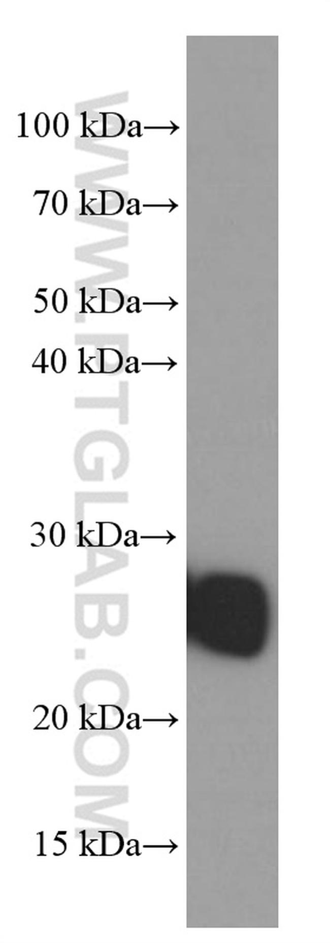 ERAB Antibody in Western Blot (WB)