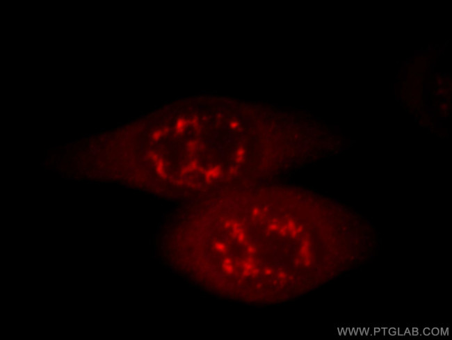 IL18 Antibody in Immunocytochemistry (ICC/IF)