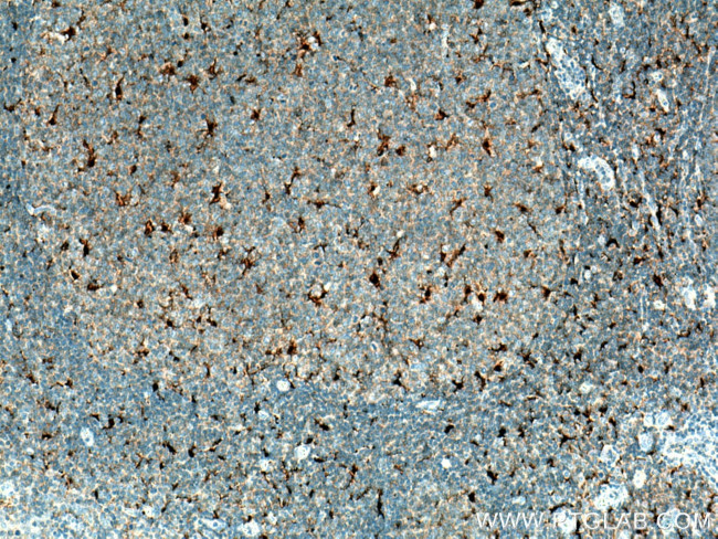 IL18 Antibody in Immunohistochemistry (Paraffin) (IHC (P))