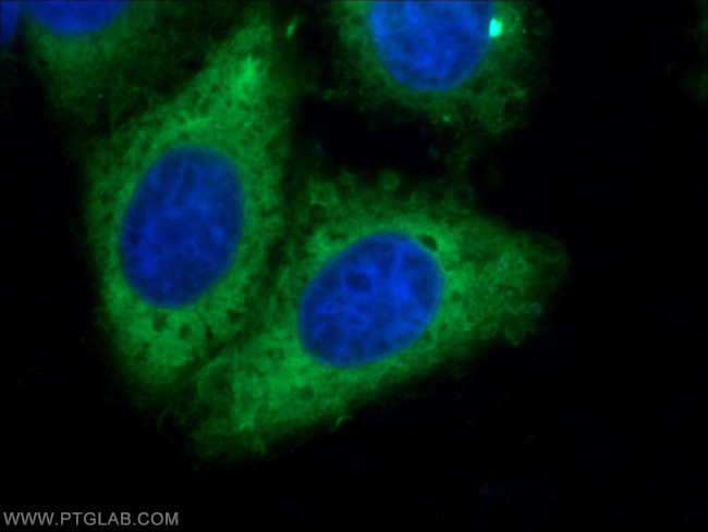 RRM1 Antibody in Immunocytochemistry (ICC/IF)