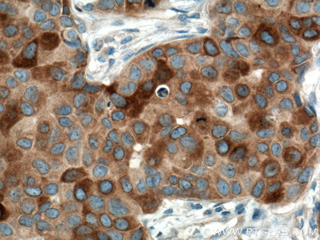 RRM1 Antibody in Immunohistochemistry (Paraffin) (IHC (P))