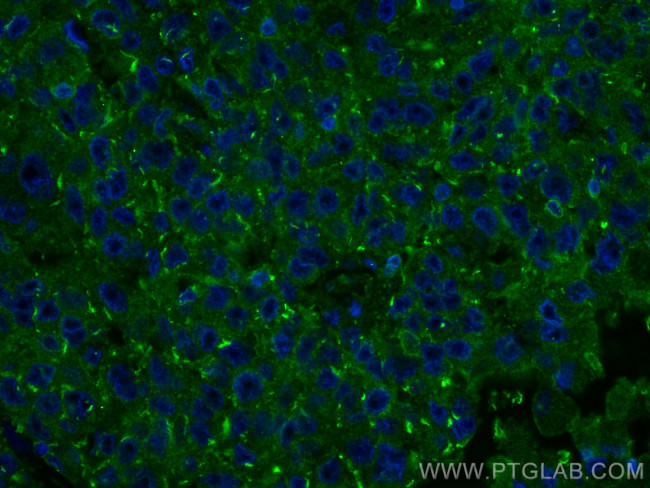 RRM1 Antibody in Immunohistochemistry (PFA fixed) (IHC (PFA))