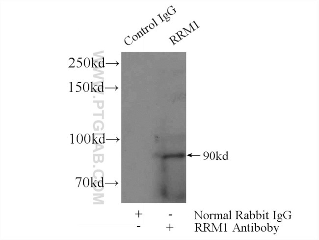 RRM1 Antibody in Immunoprecipitation (IP)