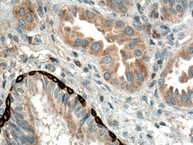 RRM1 Antibody in Immunohistochemistry (Paraffin) (IHC (P))