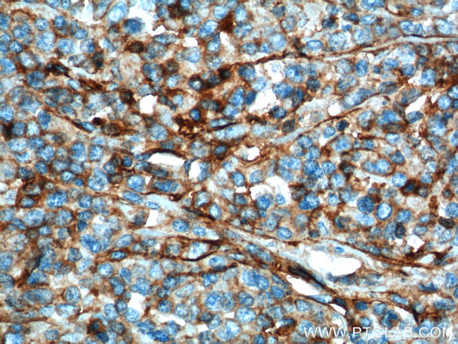 IFITM1 Antibody in Immunohistochemistry (Paraffin) (IHC (P))