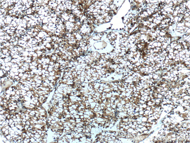 SEPT2 Antibody in Immunohistochemistry (Paraffin) (IHC (P))