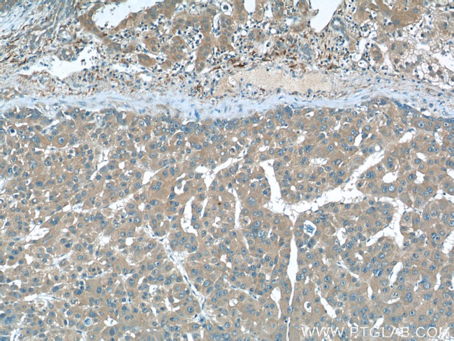 SEPT2 Antibody in Immunohistochemistry (Paraffin) (IHC (P))