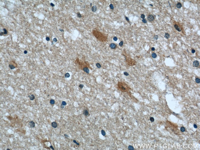 SEPT2 Antibody in Immunohistochemistry (Paraffin) (IHC (P))