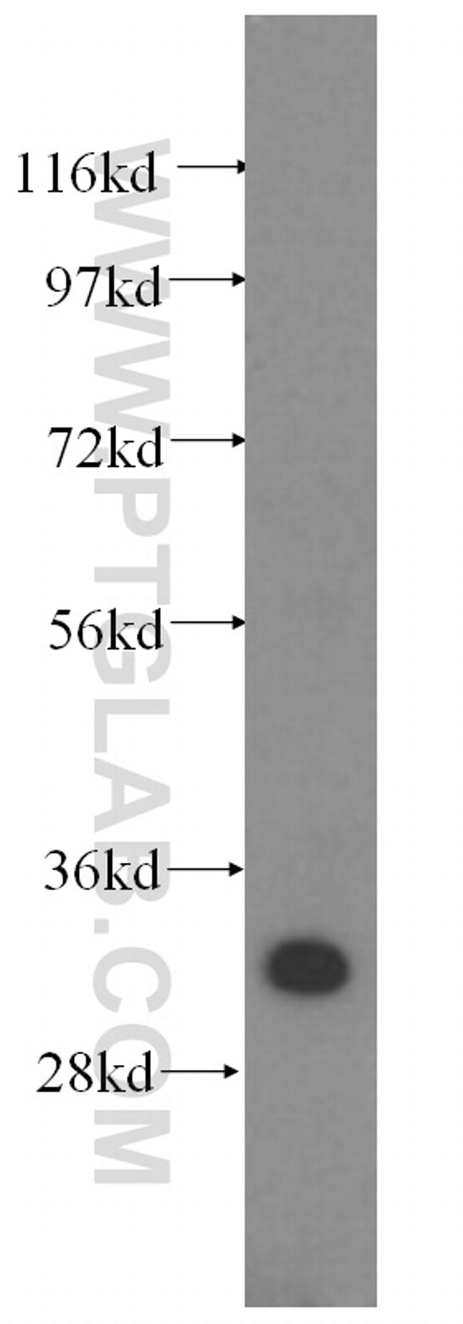 SULT1A1 Antibody in Western Blot (WB)