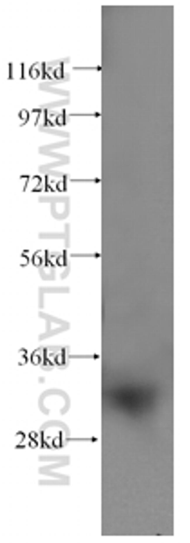 SULT1A1 Antibody in Western Blot (WB)