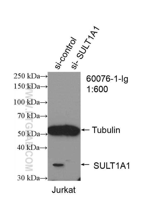 SULT1A1 Antibody in Western Blot (WB)