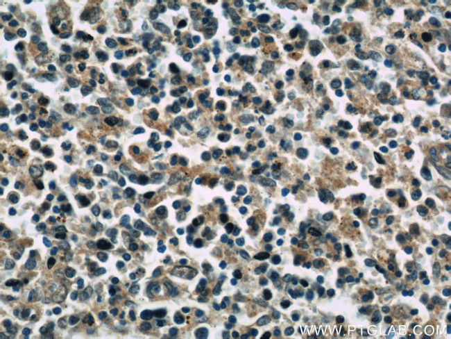 RAC2 Antibody in Immunohistochemistry (Paraffin) (IHC (P))