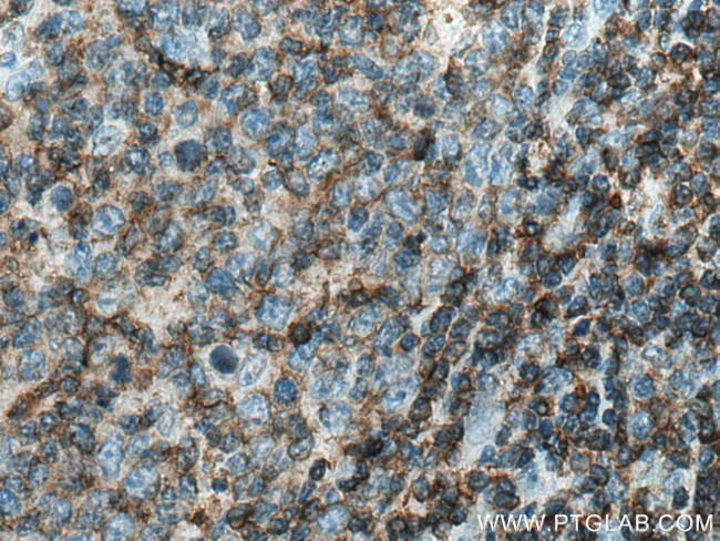 RAC2 Antibody in Immunohistochemistry (Paraffin) (IHC (P))