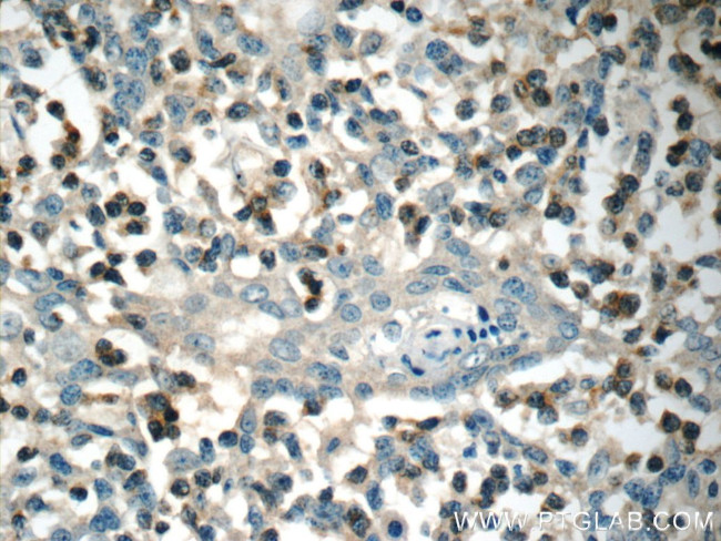 RAC2 Antibody in Immunohistochemistry (Paraffin) (IHC (P))