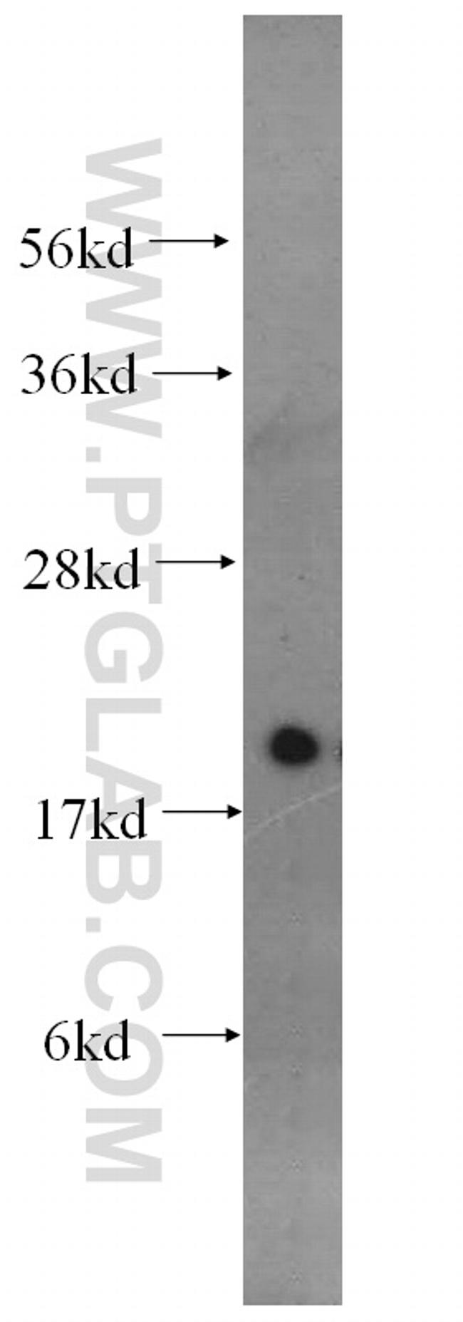 RAC2 Antibody in Western Blot (WB)