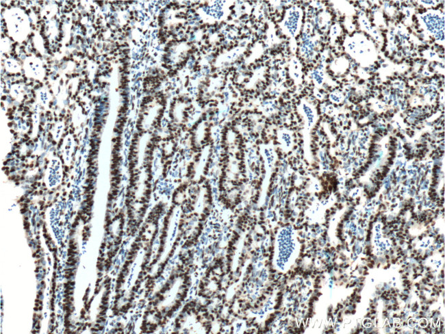 DACH1 Antibody in Immunohistochemistry (Paraffin) (IHC (P))